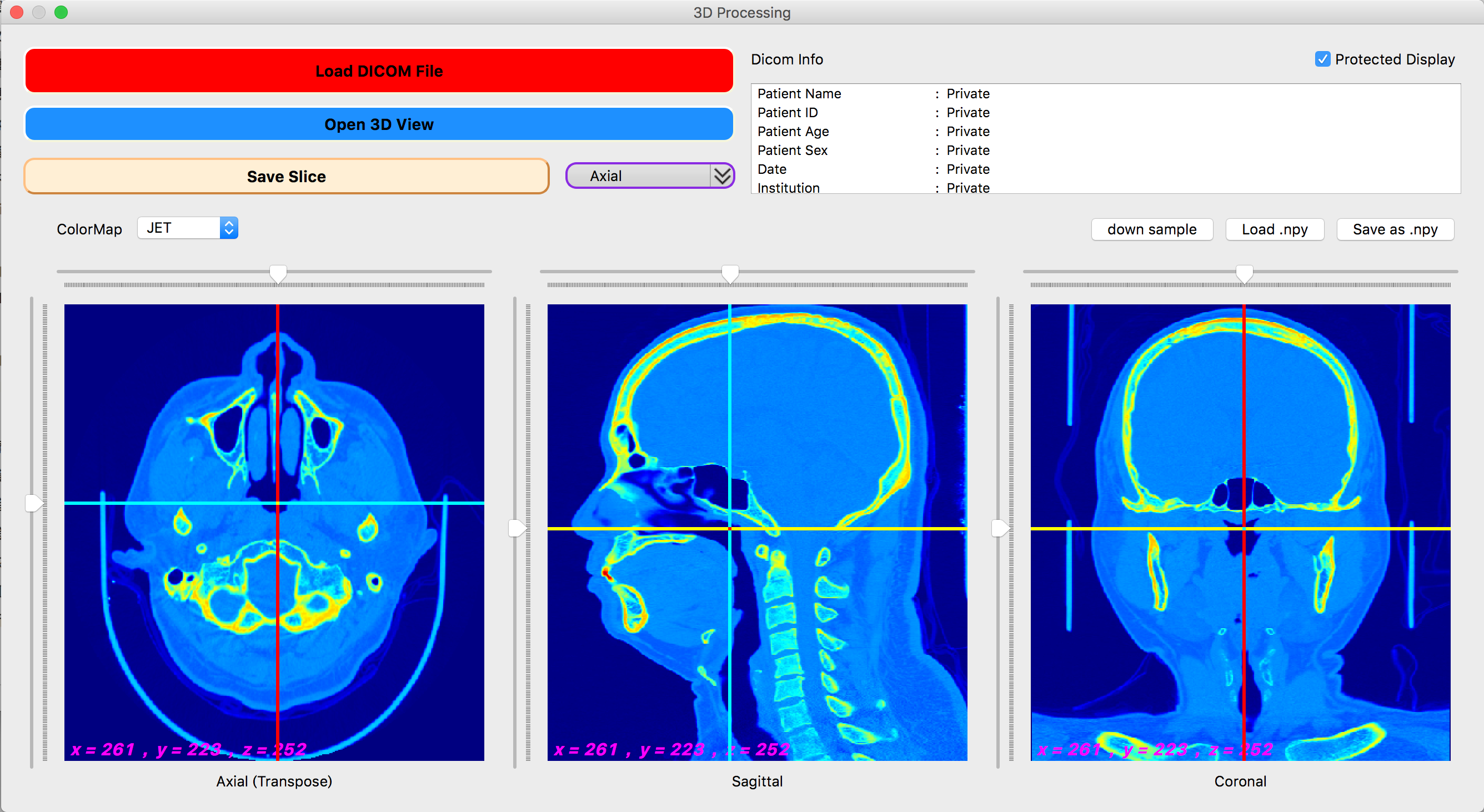 download the new version for android Sante DICOM Viewer Pro 12.2.8